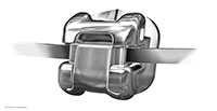 Damon bracket wire