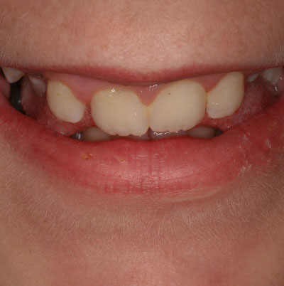 before