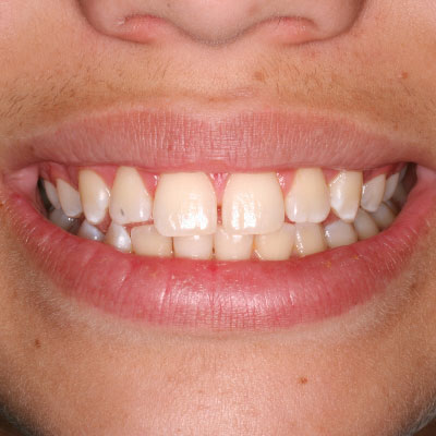 before